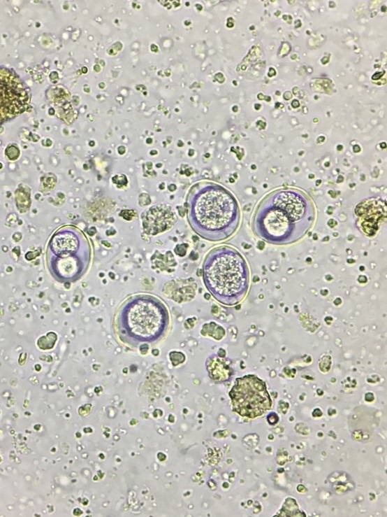 Can Humans Get Coccidia And What Is The Treatment